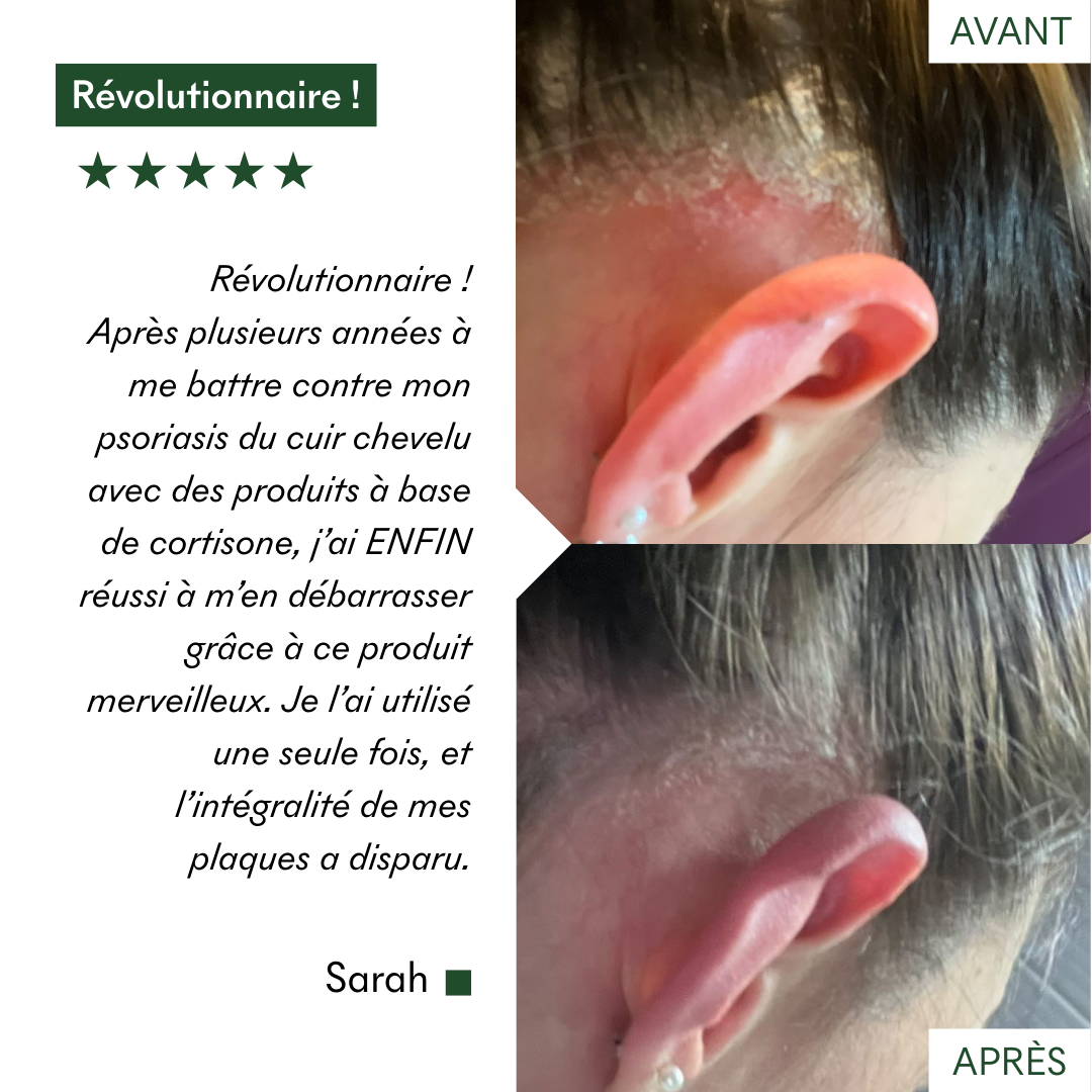 Complément SOS Plaques Sèches