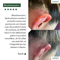 Complément SOS Plaques Sèches