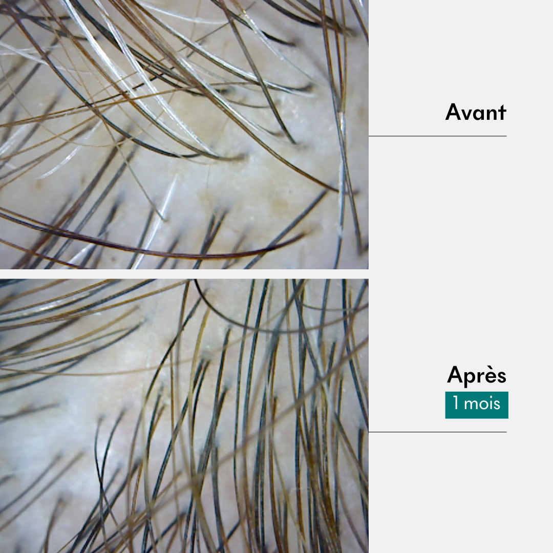 Boue Anti-âge - 1ers Cheveux Blancs