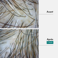 Boue Anti-âge - 1ers Cheveux Blancs