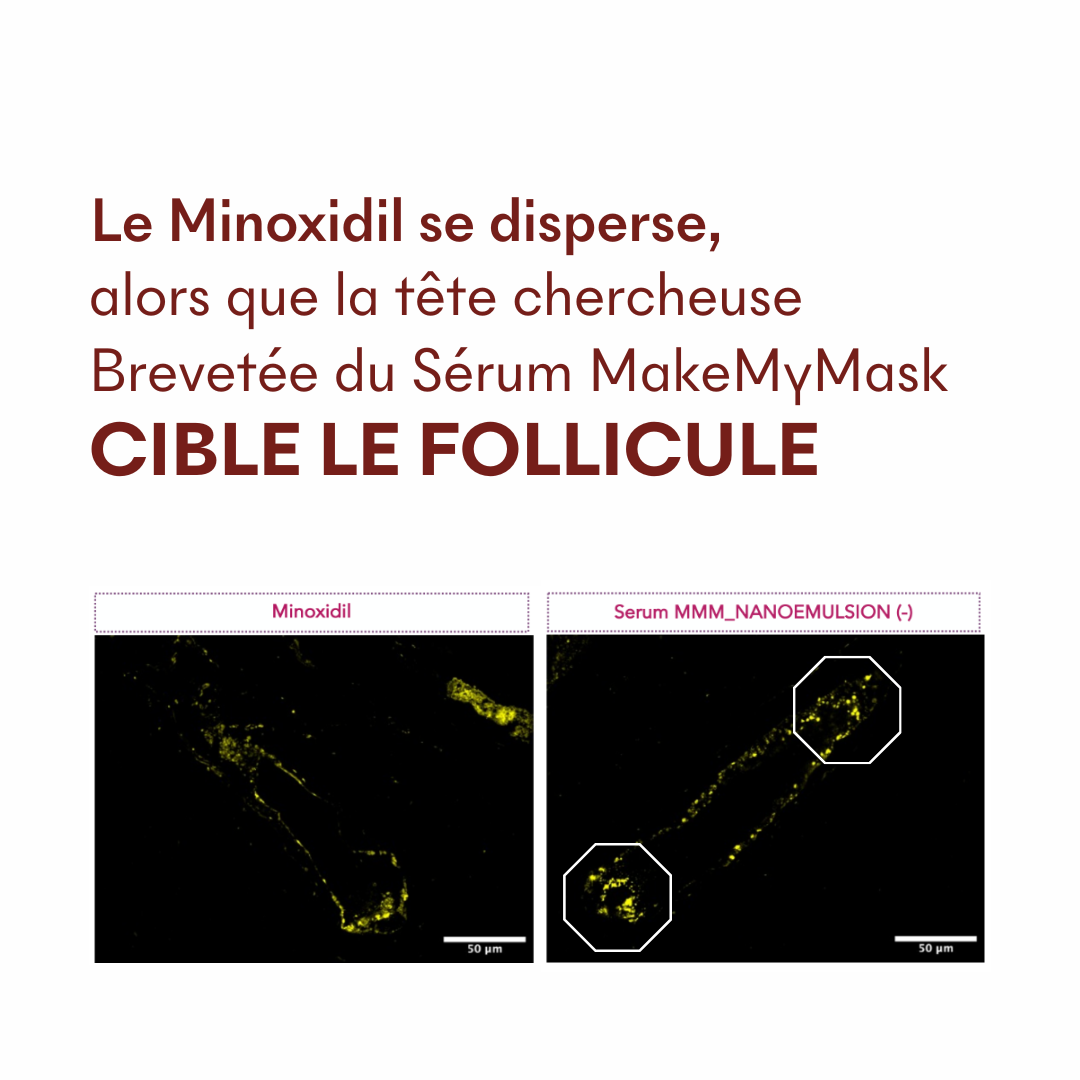 Protocole Anti-Chute Tricho-Boost