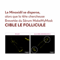 Protocole Anti-Chute Tricho-Boost