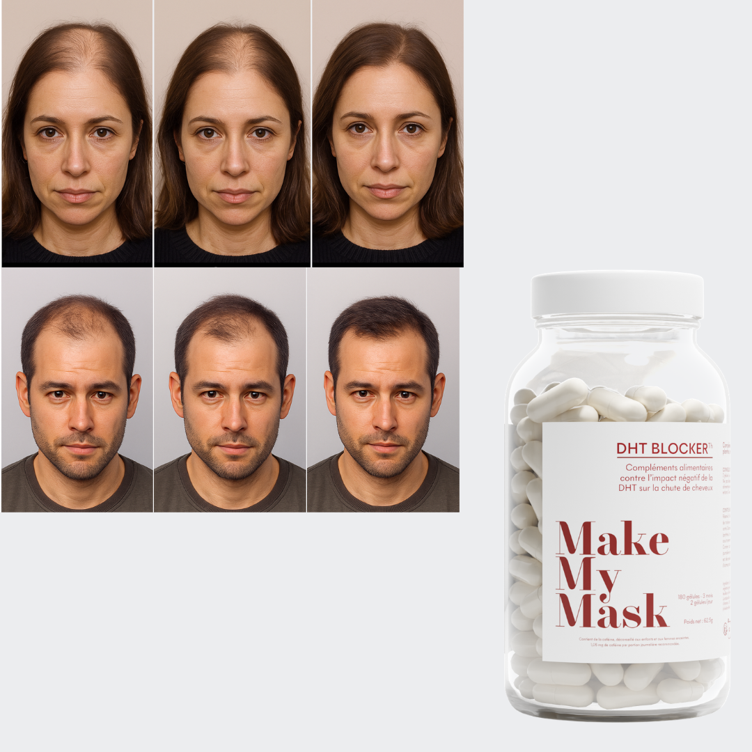 Offre 3+1 DHT Blocker Anti-Chute Hormonale 3 MOIS