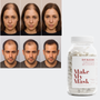 Offre 3+1 DHT Blocker Anti-Chute Hormonale 3 MOIS