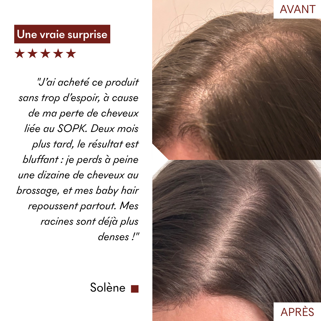 DHT Blocker Anti-Chute Hormonale 3 MOIS