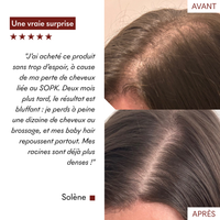 DHT Blocker Anti-Chute Hormonale 3 MOIS