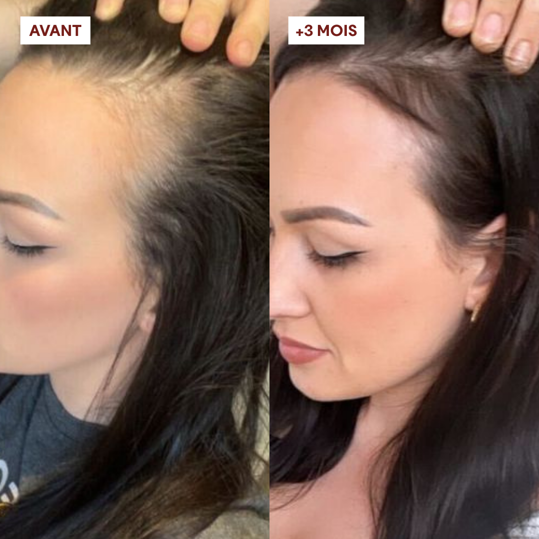 Duo Gommage Actif + Shampoing Anti-chute