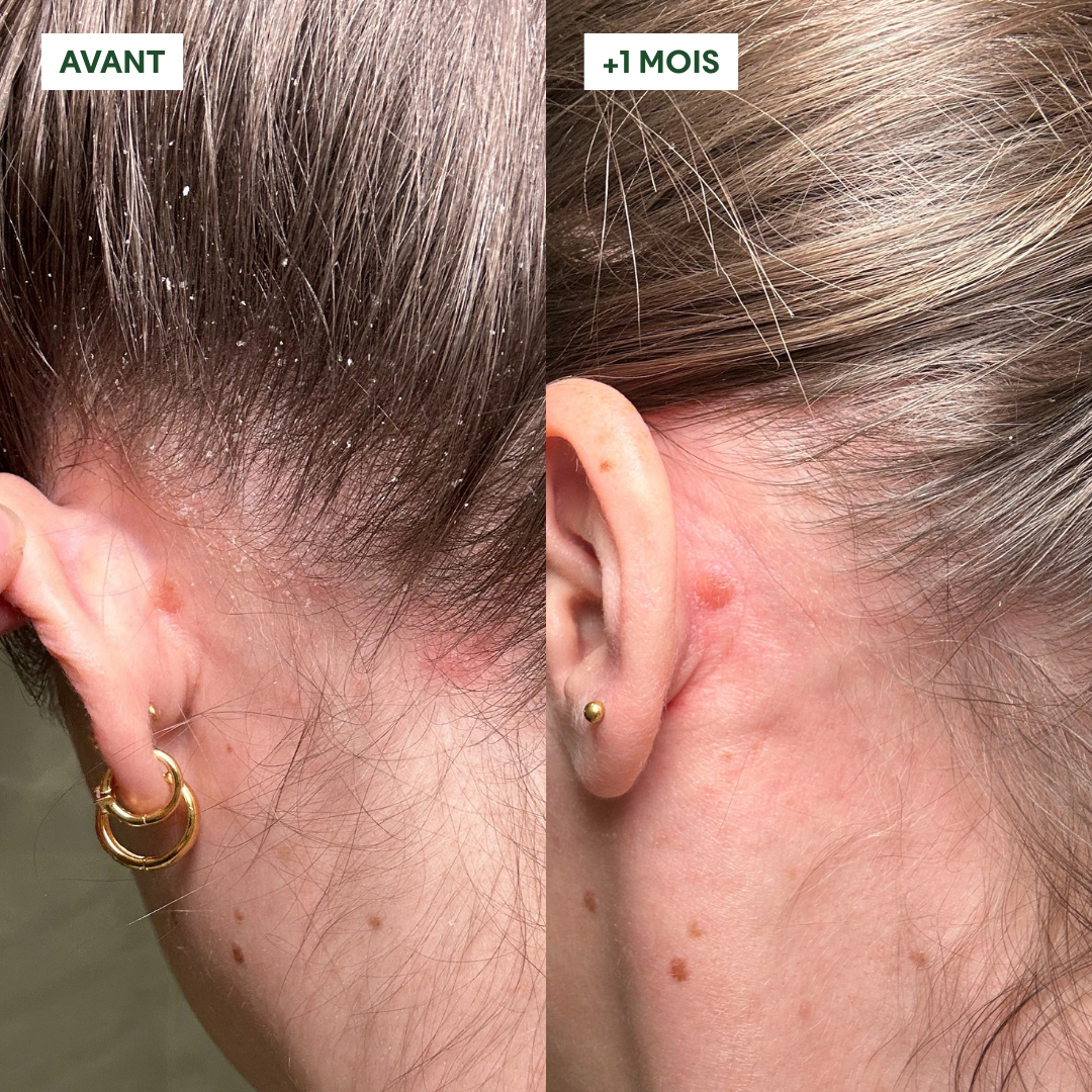 Duo Gommage Actif + Shampoing Anti-Pelliculaire