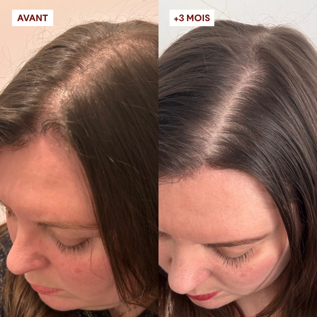 Duo Gommage Actif + Shampoing Anti-chute
