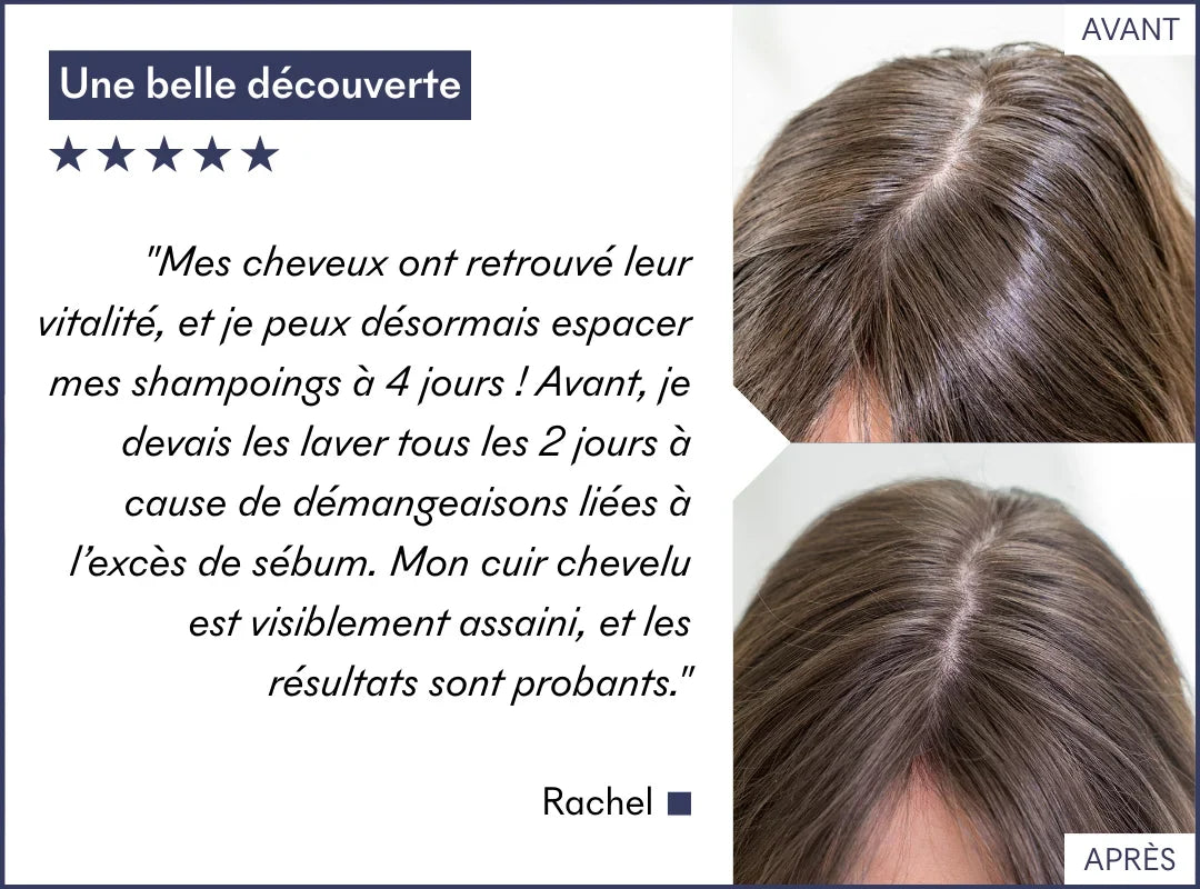 VOS RÉSULTATS