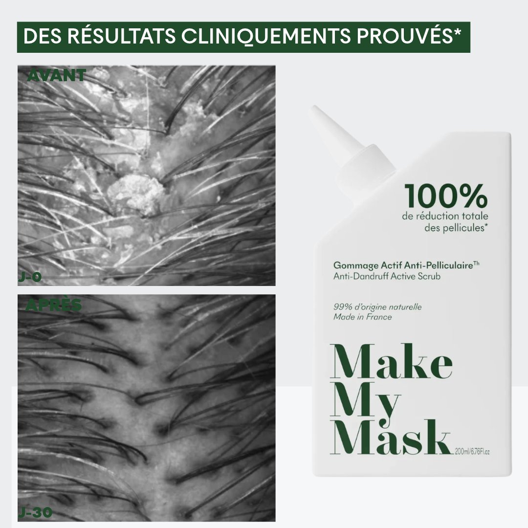 Gommage Actif Anti-Pelliculaire