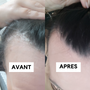 Concentré Anti-PSO cuir chevelu Tricho-Pure_