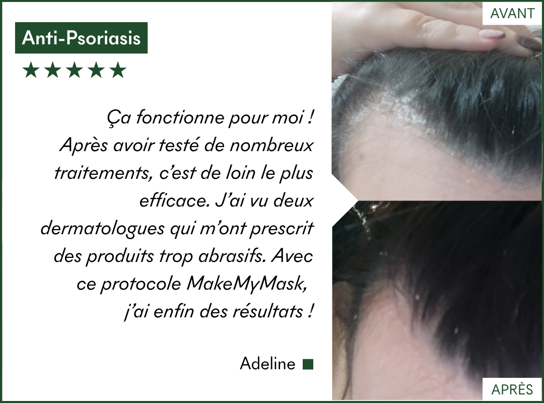 VOS RÉSULTATS