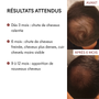 Offre 3+1 DHT Blocker Anti-Chute Hormonale 3 MOIS