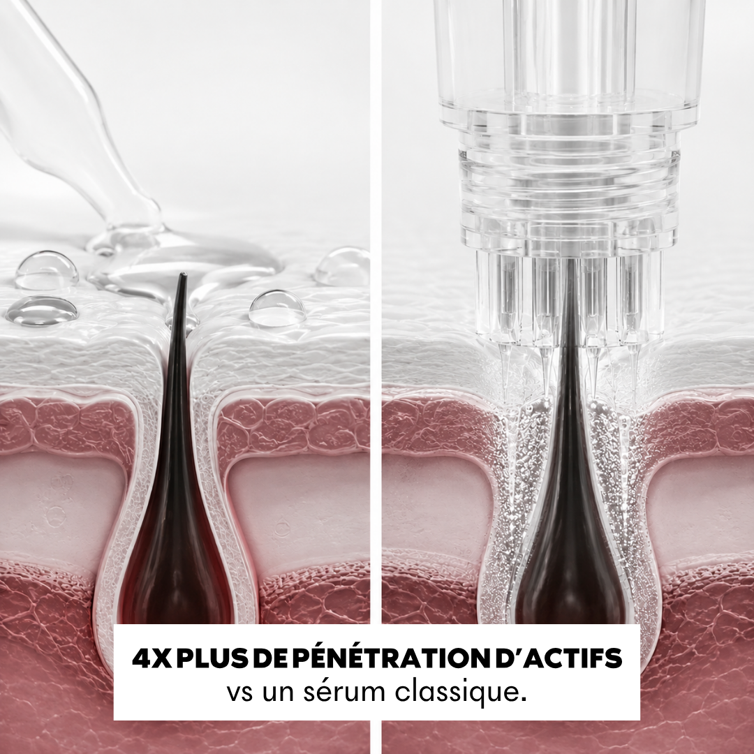 Anti-Haarausfall-Mikroinfusionspackung + gratis DHT