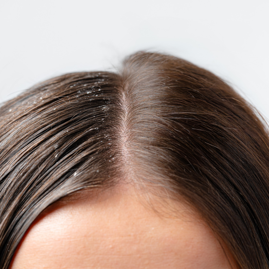 Duo Gommage Actif + Shampoing Anti-Pelliculaire