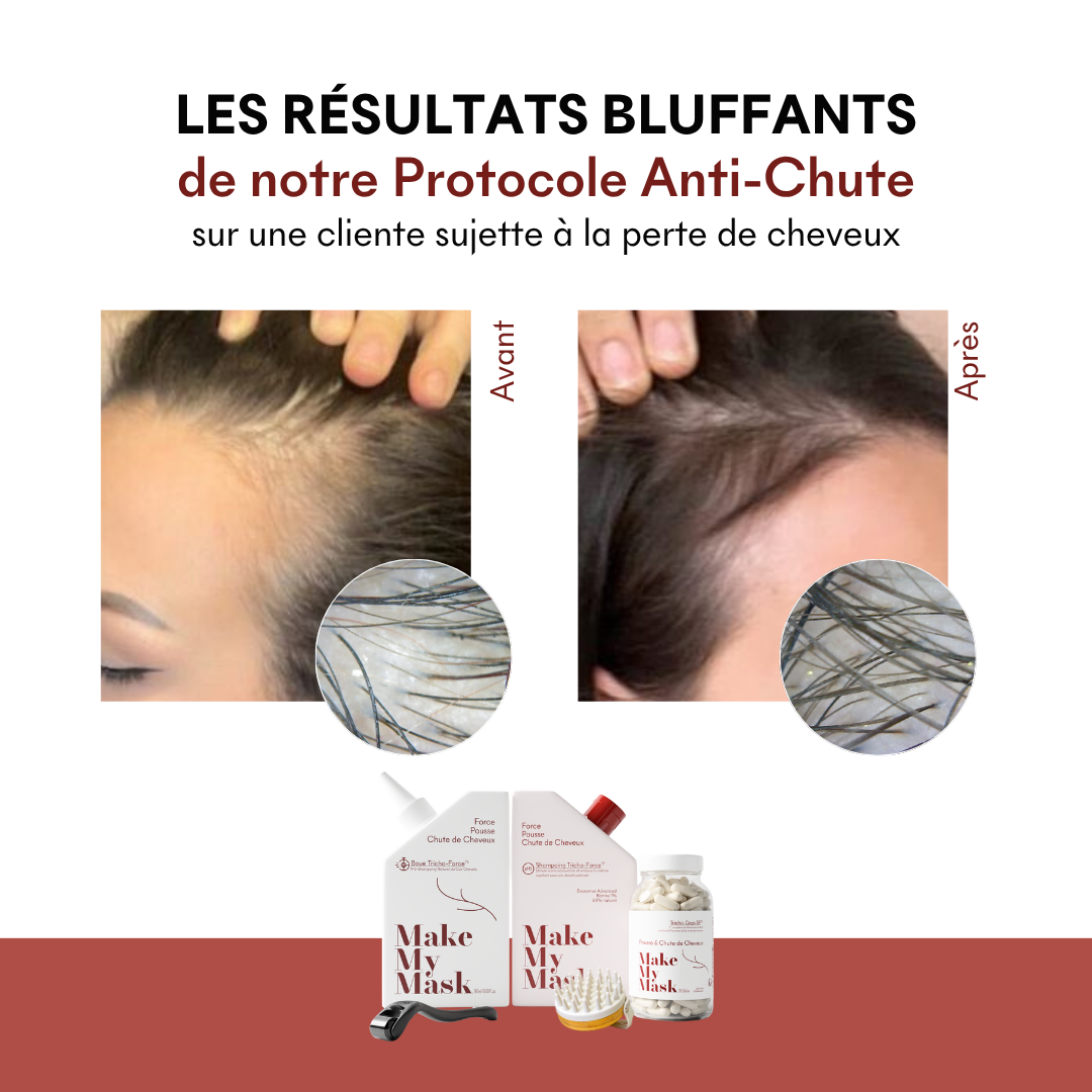 Offre 3+1 Shampoing Anti-Chute Tricho-Force pH5