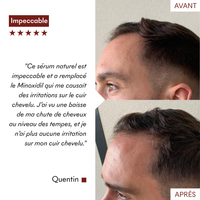 DHT Blocker Anti-Chute Hormonale 3 MOIS