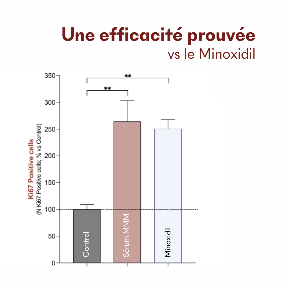 Offre 3+1 Sérum Anti-Chute Tricho-Boost
